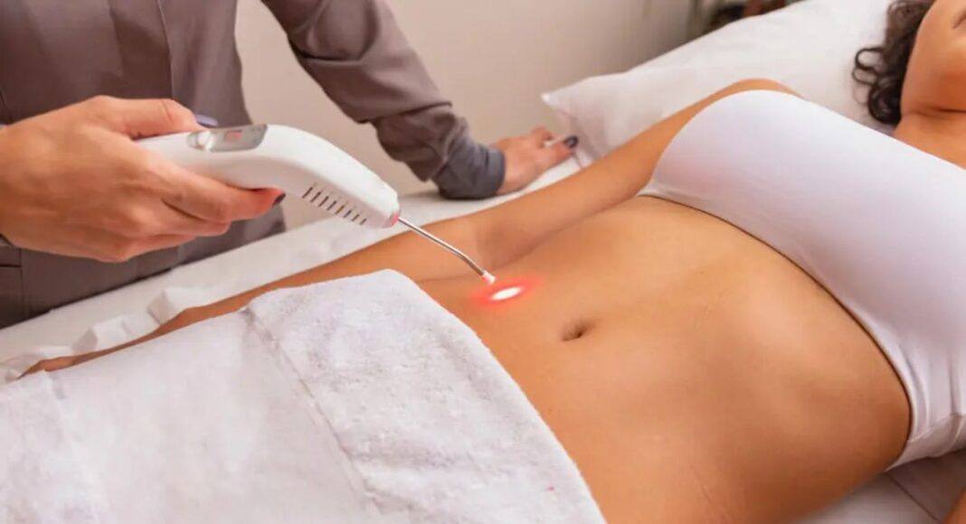 laserterapia